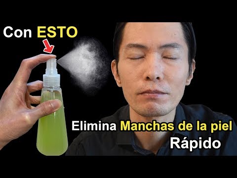 ESTO eliminará las Manchas de la Cara (<strong>Lentigo</strong> solar,Melasma) y previene el Cáncer de Piel