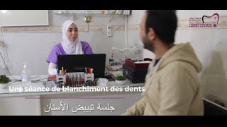 blanchiment dentaire تبييض الأسنان