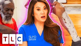 “This Is One Of The Worst Cases Of Psoriasis That I’ve Ever Seen!” | Dr Pimple Popper