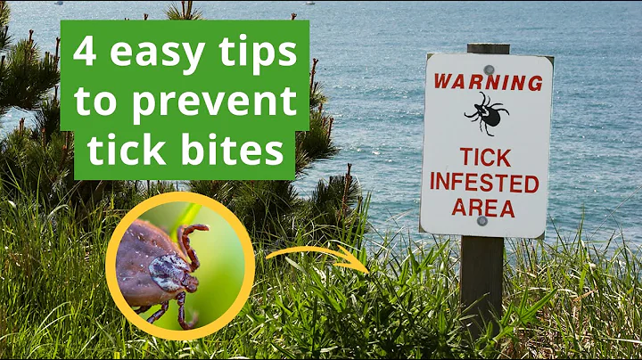 4 Easy Tips to Prevent Tick Bites