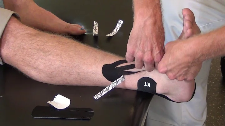 How long is a fractured ankle swollen? (2023)