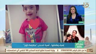 صباح الخير يا مصر | إسراء وطفلها مروان .. أسرة تتحدى “ متلازمة داون