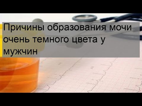 Причины образования мочи очень темного цвета у мужчин