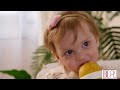 Diaper Rash Video in English