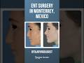 Choosing Otolaryngology In Monterrey Affordable Medical Care Ent Ear Nose Throat