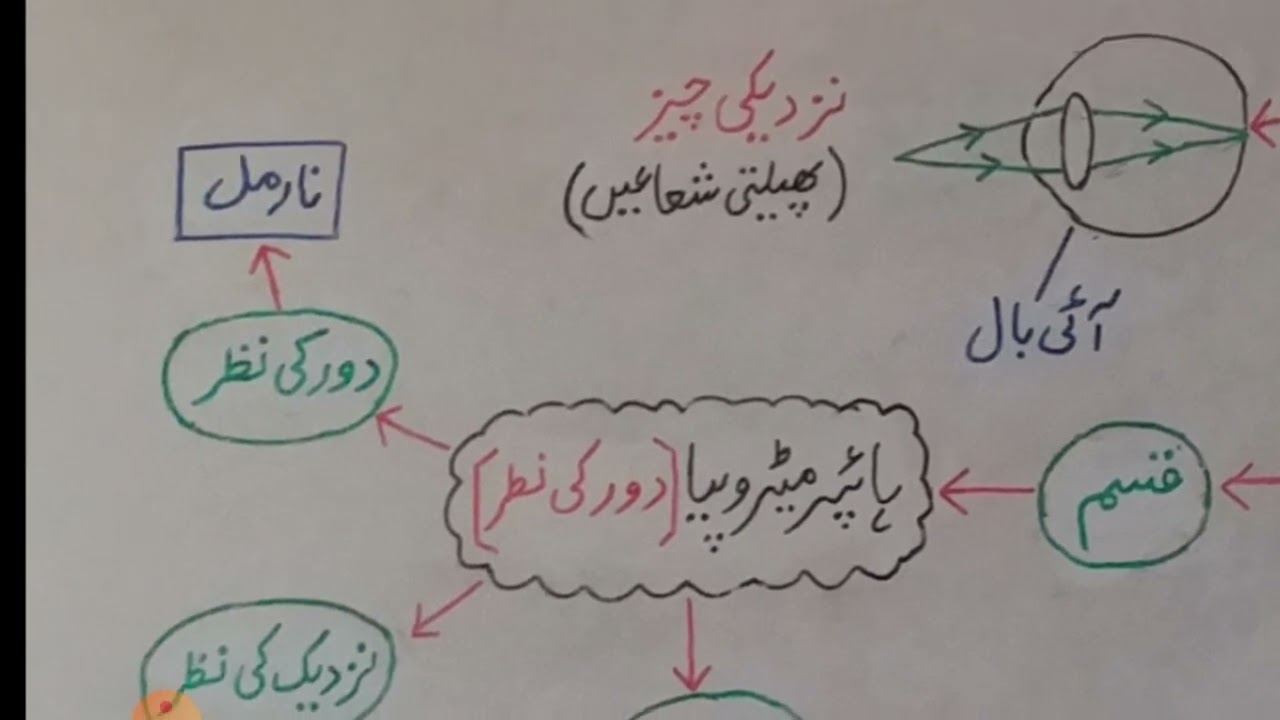 Disorders of Eye آنکھ کے نکائص