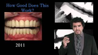 185-00 A New Common Sense Approach to Full Mouth Rehabilitation Using Direct Composite PREVIEW