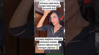 Wajah Ashanty Terlihat Sangat Kurus