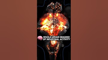 Whole-brain imaging of neuronal activity #Neuroscience #Neuroplasticity #Brain #Science #Microscope