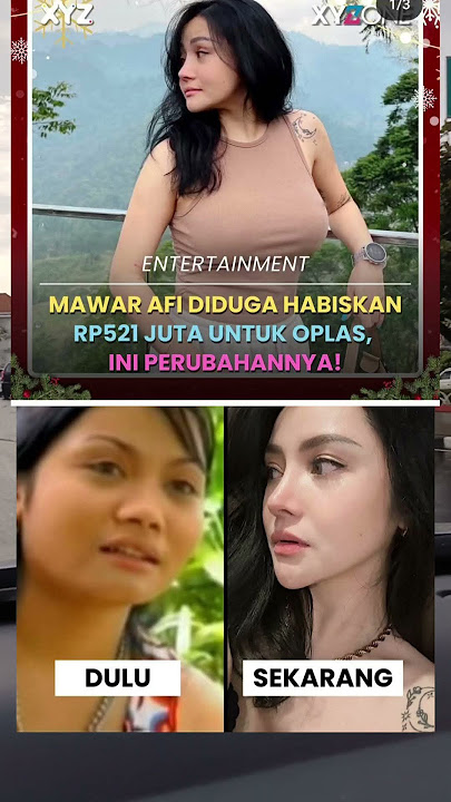 Penampilan Afi Mawar Semakin Cantik.  Diduga Habiskan Rp 521 Juta untuk Oplas #shorts