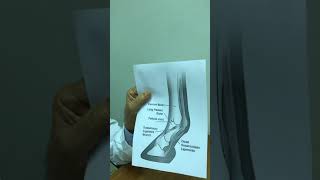 مفصل المعقم في الخيل affection of fetlock joint in horse