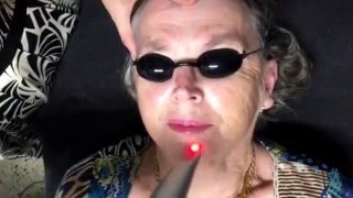 Rev Lite Laser Skin Toning and Rejuvenation by Dr Carolyn Choy @ Ultimate Aesthetics