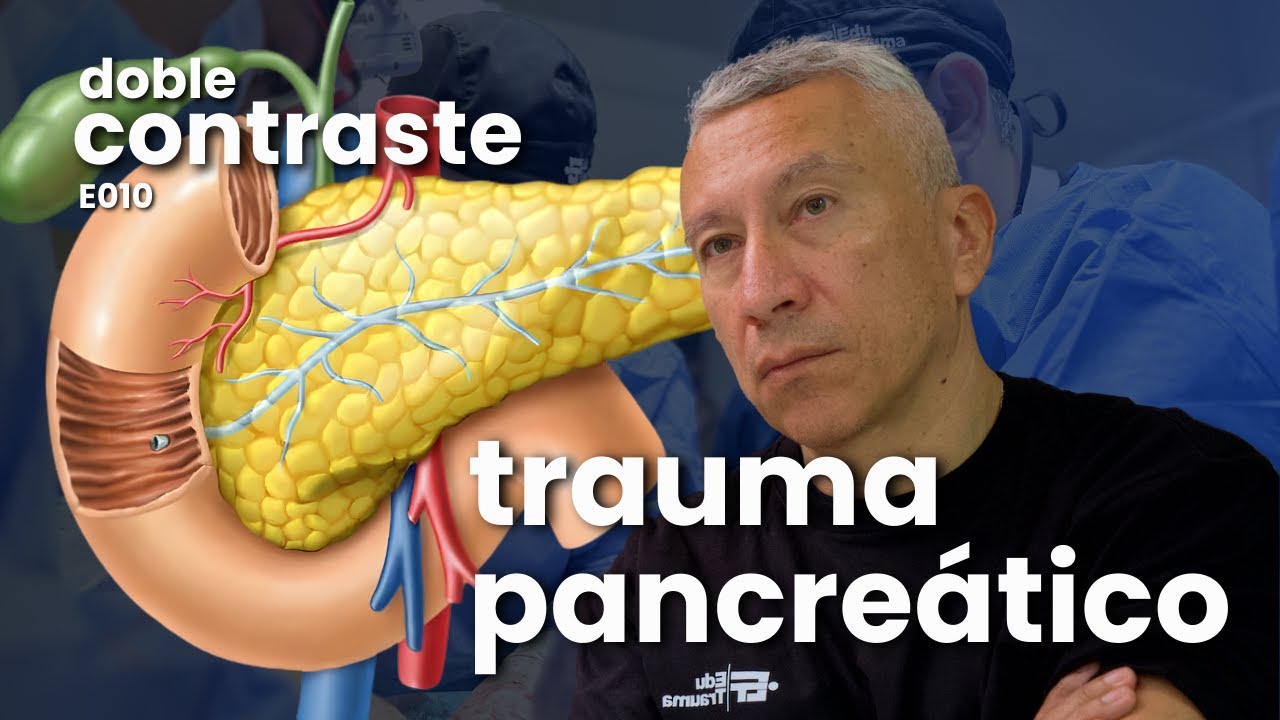 Trauma pancreático con el Dr. Napoleón Méndez | Doble Contraste - Episodio 9
