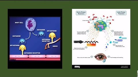 Thuốc kháng histamine