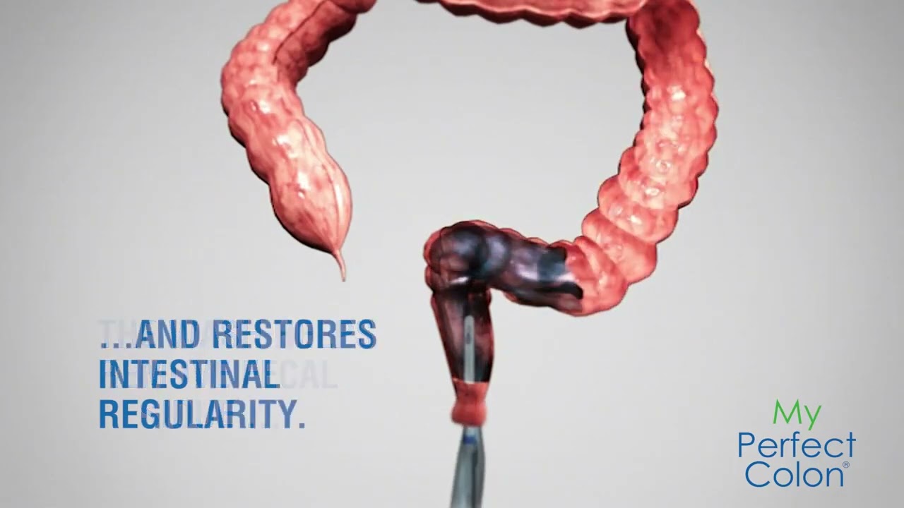 My Perfect Colon Care & Fast