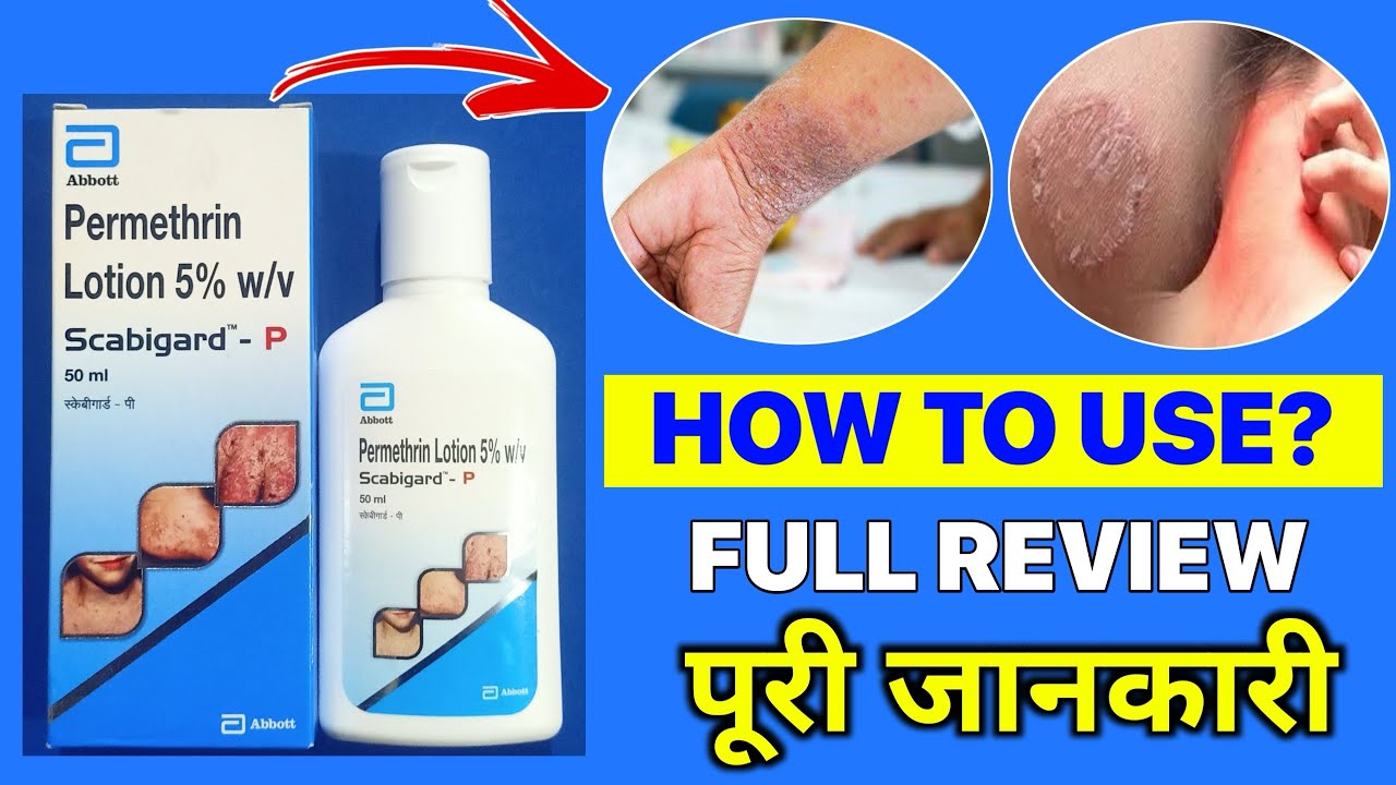 Scabigard p lotion use in Hindi by take health YouTube