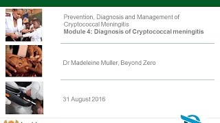 BZ Video Tutorial CM Module 4 Diagnosis of CM