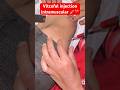 Buttock Injection Ka Sahi Tarika | IM Injection #Shorts