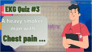 ECG quiz with explanation | a man with chest pain | ECG case study