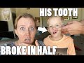 MICHAEL BROKE HIS TOOTH IN HALF!! || Mommy Monday