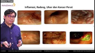 Webinar Gastrik, GERD dan Ramadhan [Siri 6] screenshot 2