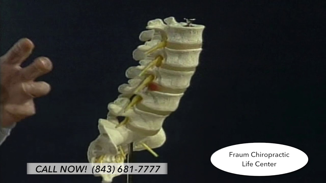 Fraum Chiropractic DRX9000 Educational Video YouTube
