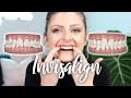 I GOT INVISALIGN! | IN DEPTH: All About My Teeth + 1 Week Review + TIPS!