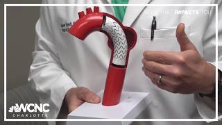 Doctors highlight warning signs of aortic dissection after Lindsey Graham's death