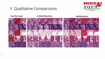 Cross-modulated Few-shot Image Generation forColorectal Tissue Classification - MICCAI 2023