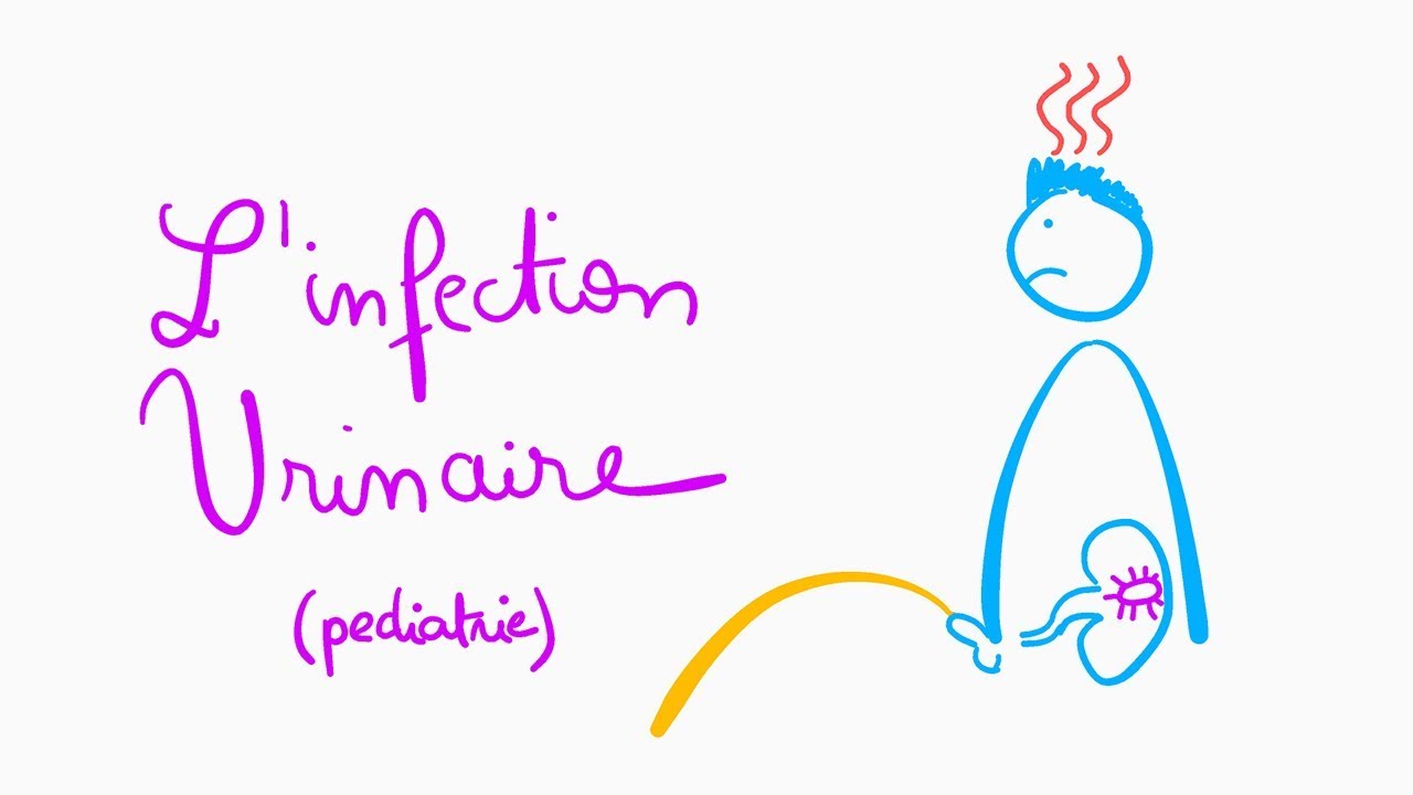 🔴 L'EXPLICATION LA PLUS CLAIRE DE L'INFECTION URINAIRE PEDIATRIQUE !