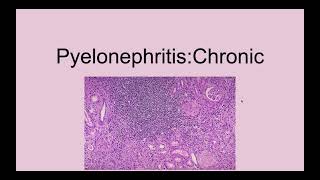 Chronic Pyelonephritis