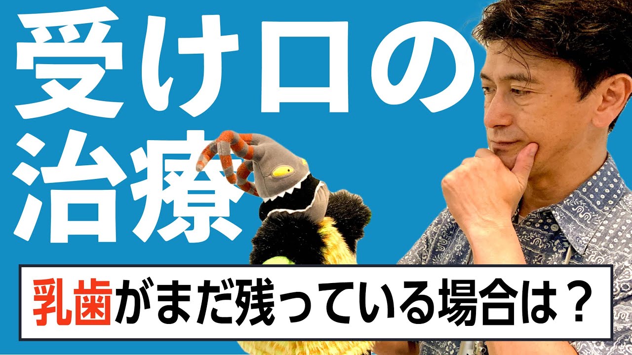 受け口の矯正治療 Vol. 1, 乳歯〜混合歯列期の治療