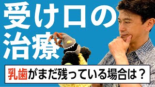 受け口の矯正治療 Vol. 1, 乳歯〜混合歯列期の治療