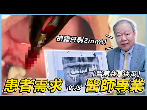 【植牙常識這裡看！植牙專業朱裕華醫師來講解！EP.2】植體與骨頭咬合只剩2mm還可以使用嗎？ #注意事項 #骨頭