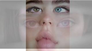 Sarah Mcdaniels Blue Eye Looks So Familiar Fake Eye Expose