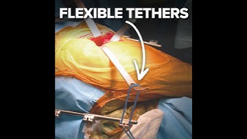 Flexible Tethers