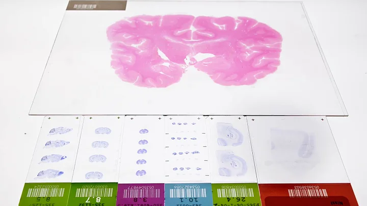 Mapping Cortical Cell Types