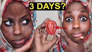 Maajabu ya NYANYA | Kuondoa CHUNUSI na MADOA SUGU | Tomato Scrub For Fairness | Spotless skin