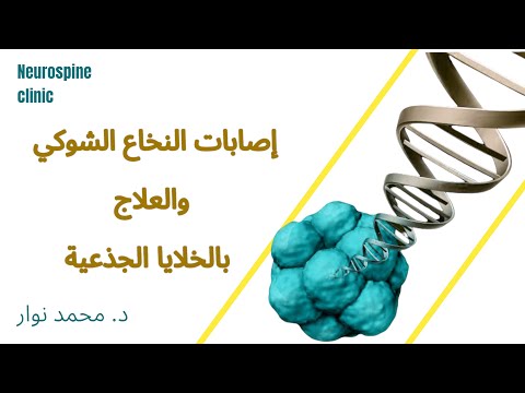 إصابات النخاع الشوكى والعلاج بالخلايا الجذعيه