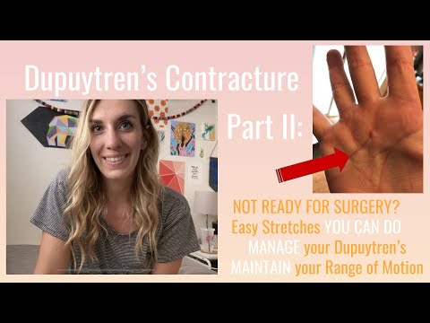 Dupuytren&rsquo;s Part II: Easy Stretches YOU CAN DO!