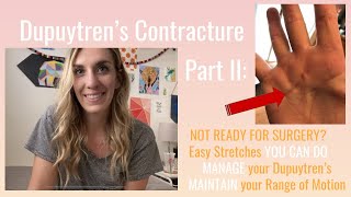 Dupuytren's Part II: Easy Stretches YOU CAN DO!