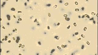 Swimming Algae