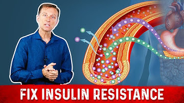 7 Things That Boost Insulin Sensitivity or Reverse Insulin Resistance - Dr. Berg