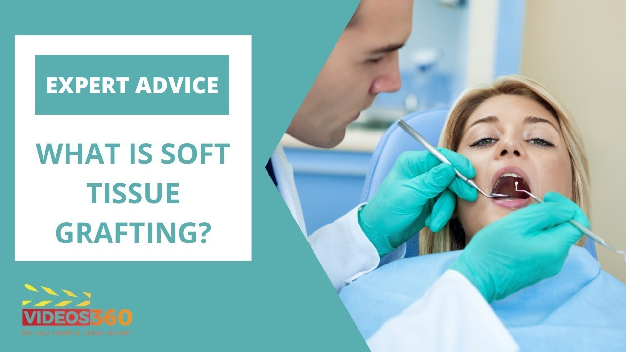 Soft Tissue Grafting Burlington ON - Gum Recession Treatment