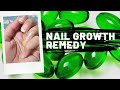 home remedy for healthy nails.how to use vitamin E.nail growth tips.