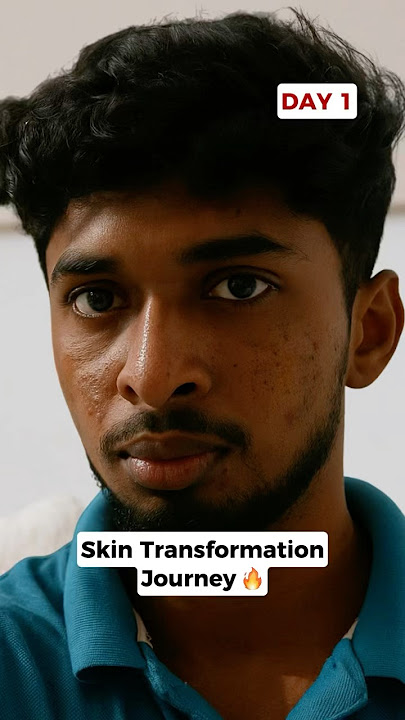 Tranform your skin with our woodoo's hello clear skin face wash!! #ytshorts #shorts #woodoo