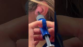 Dr. Wikoff gets ear mold impression...