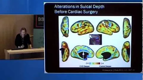 Discover Brigham Newborn Brain Development Research Video - Brigham and Women's Hospital