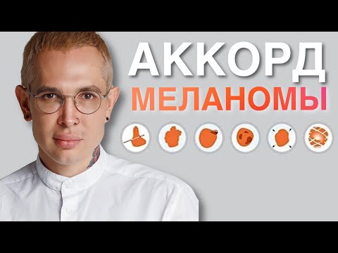 МЕЛАНОМА как распознать опасные родинки | ранняя диангостика