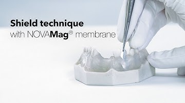 Shield technique with NOVAMag® membrane